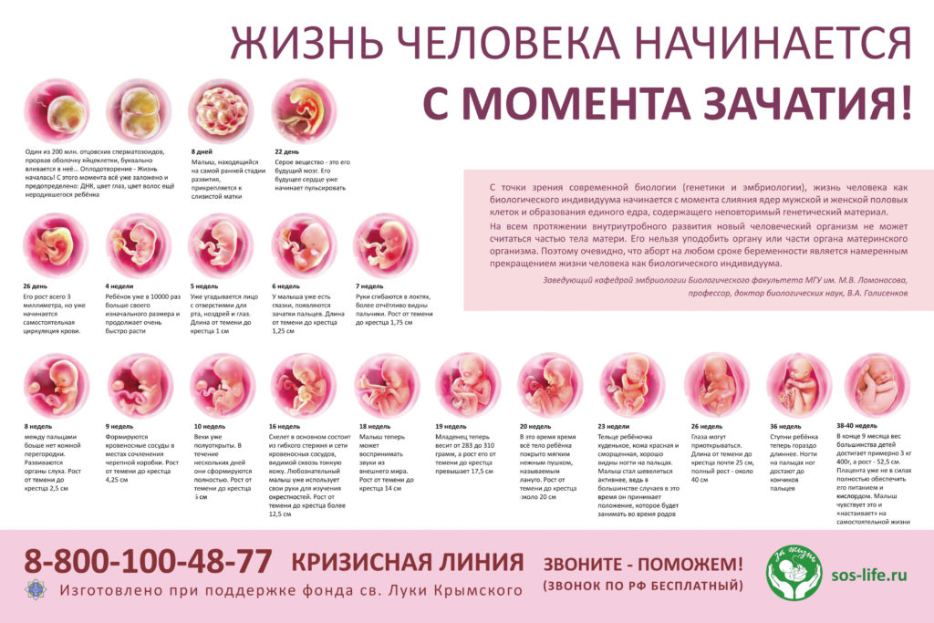 №2-Жизнь-человека-2016-1024x683.jpg